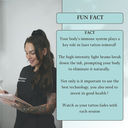 Tattoo Laser Removal
